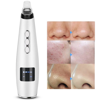 Electric blackhead suction instrument with interchangeable tips for facial pore cleansing and targeted skin care