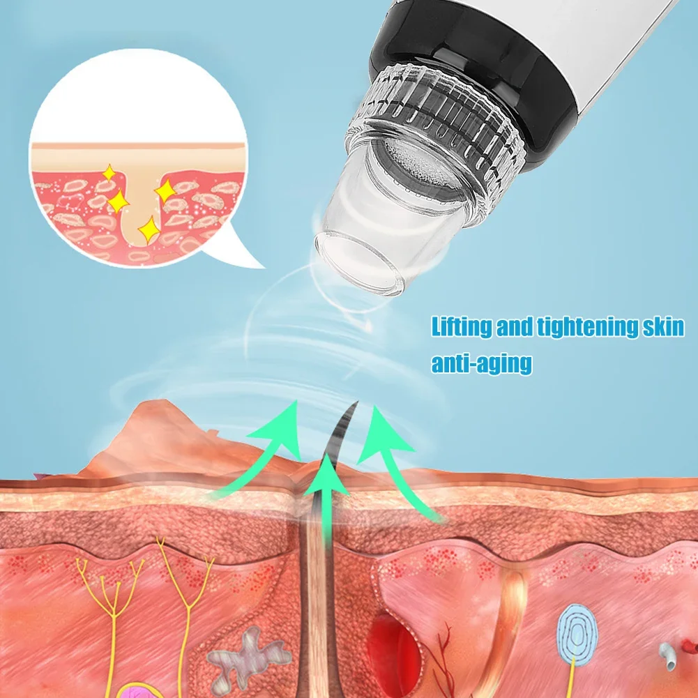 BRELZA electric blackhead suction instrument displaying handheld face cleaner with extraction nozzle for daily skincare.